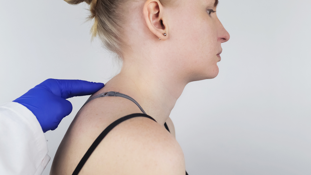 Gloved Hand Points To Tech Neck Hump On Woman's Upper Back