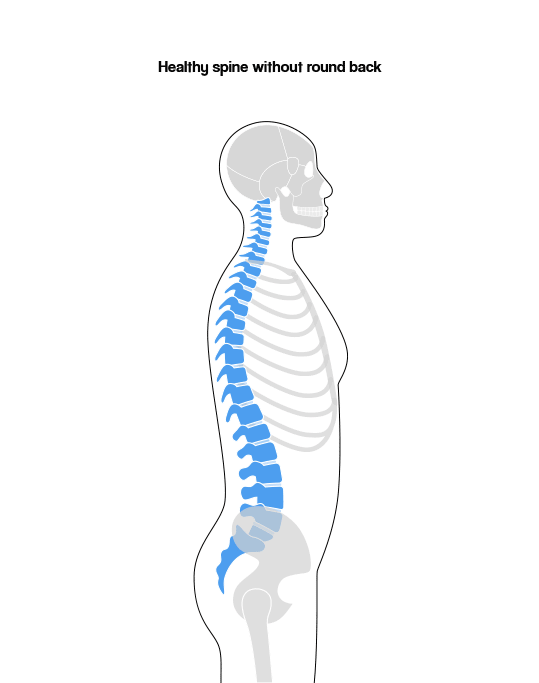 Forme® For Round Back